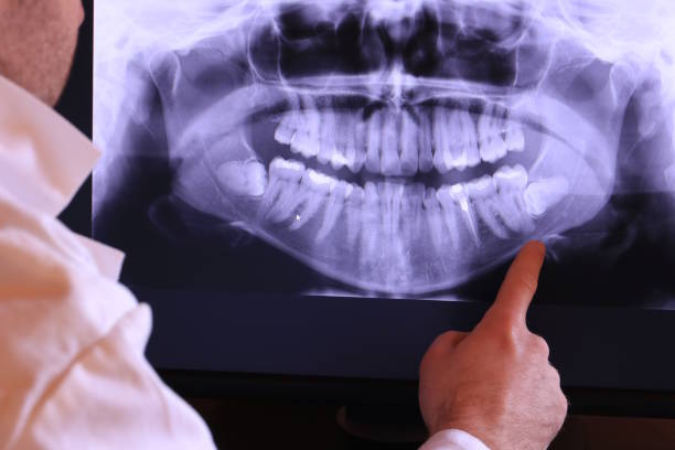 Best Cracked Tooth Emergency Dentist  in Huntsville, MO