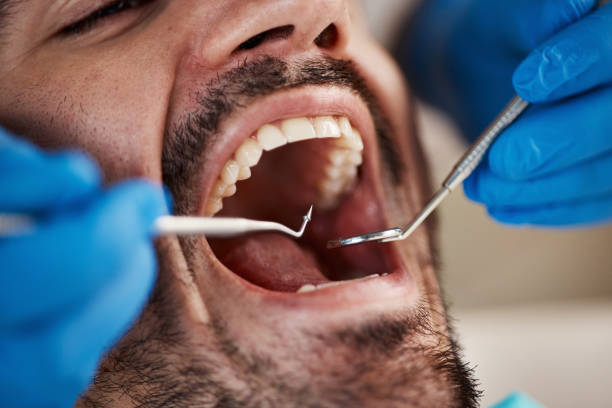 Best Emergency Dentist Near Me  in Huntsville, MO